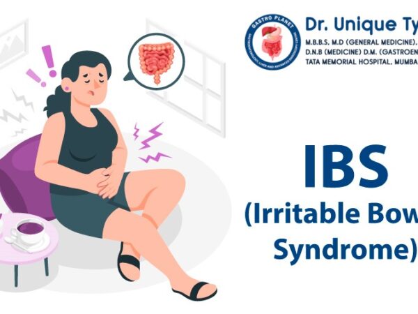 Irritable Bowel Syndrome