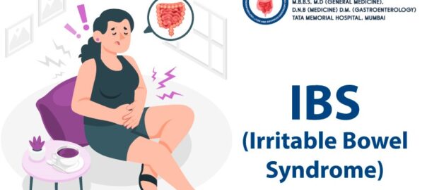 Irritable Bowel Syndrome